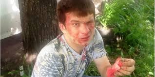 В Ульяновске зверски избит активист ПАРНАСА